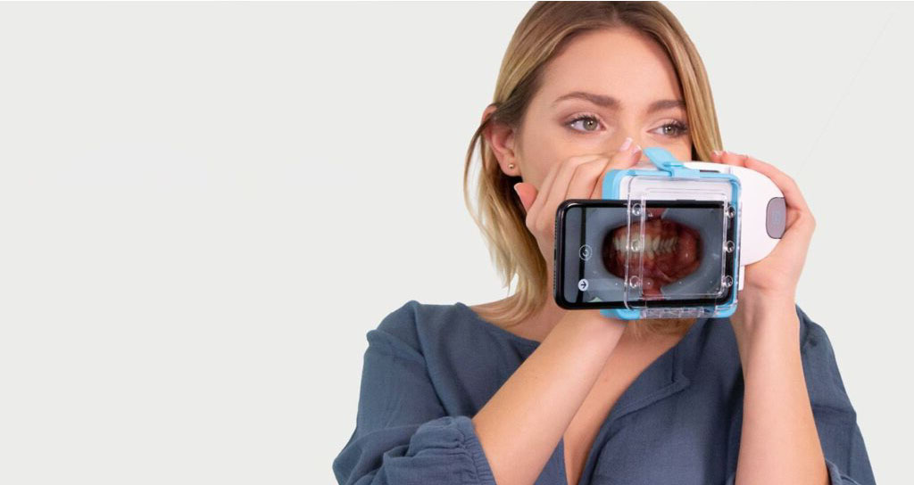 Paziente utilizza l'app Dental Monitoring sul telefono