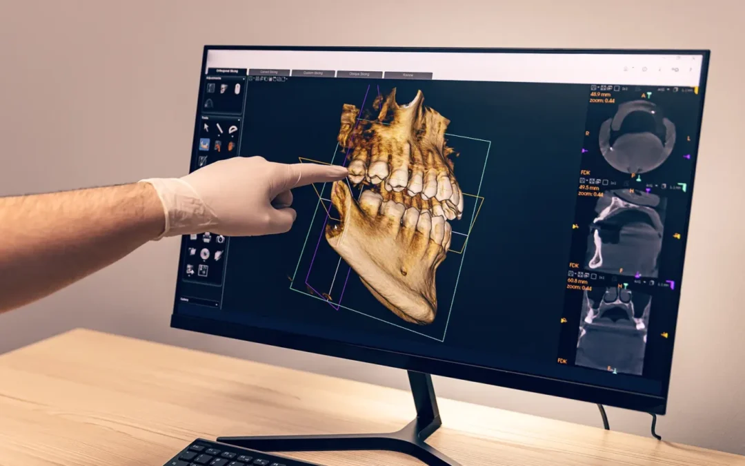 Impianti dentali: tecnologie avanzate, comfort e fiducia per tornare a sorridere