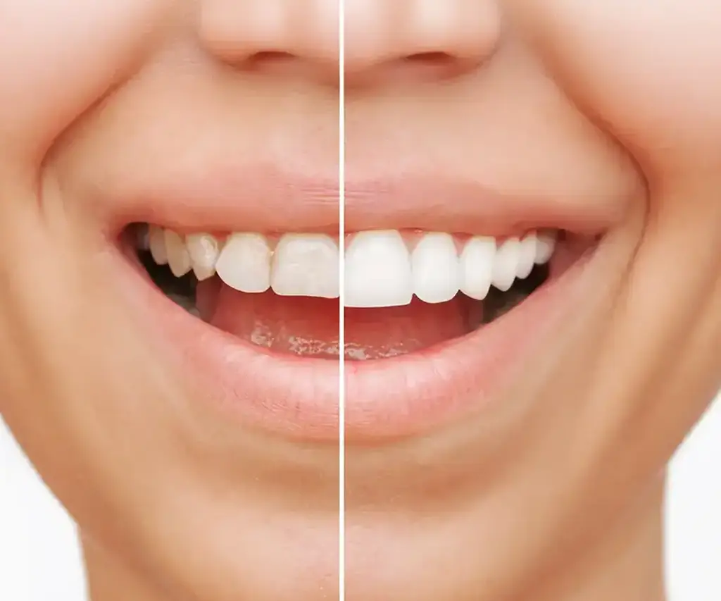 Estetica Dentale Simulazione 3d - Confident