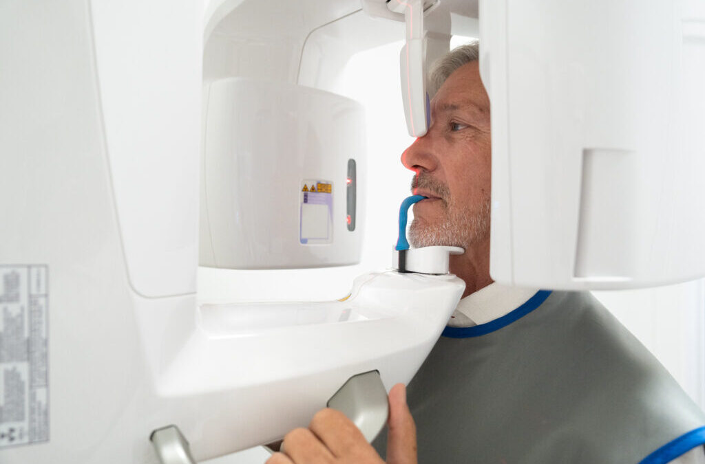 Cos’è la TAC 3D dentale e come funziona?