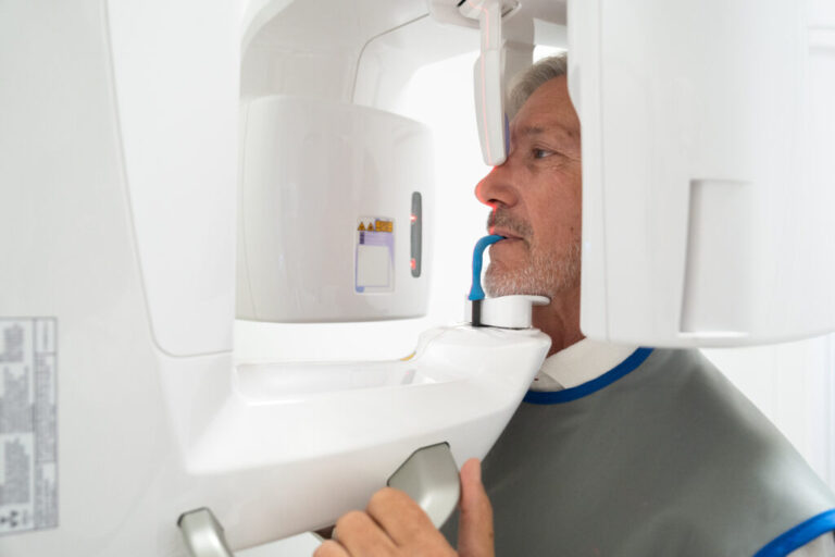 Cos'è la TAC 3D dentale e come funziona?